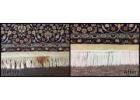 Oriental Rug Service: Trusted Rug Repair Company in Rochester Hills