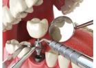 Dr. Helen’s Dental & Implant Studio- Best Dental Implants in Melbourne