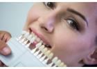 Transform Your Smile with a Veneer on Front Tooth