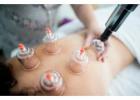 Melbourne’s Trusted Chinese Cupping Therapy Experts