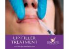 Lip Fillers Bedfordshire: Safe, Stunning Results You’ll Love!