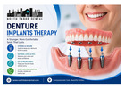 Is Denture Implants Therapy Right for You?