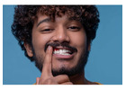 Periodontist in Tijuana – Advanced Gum Care for a Healthier Smile