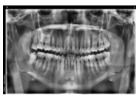 Holistic Dentist in Mexico – Natural, Biocompatible Care for Your Health and Smile