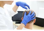 Prp Hair Treatment